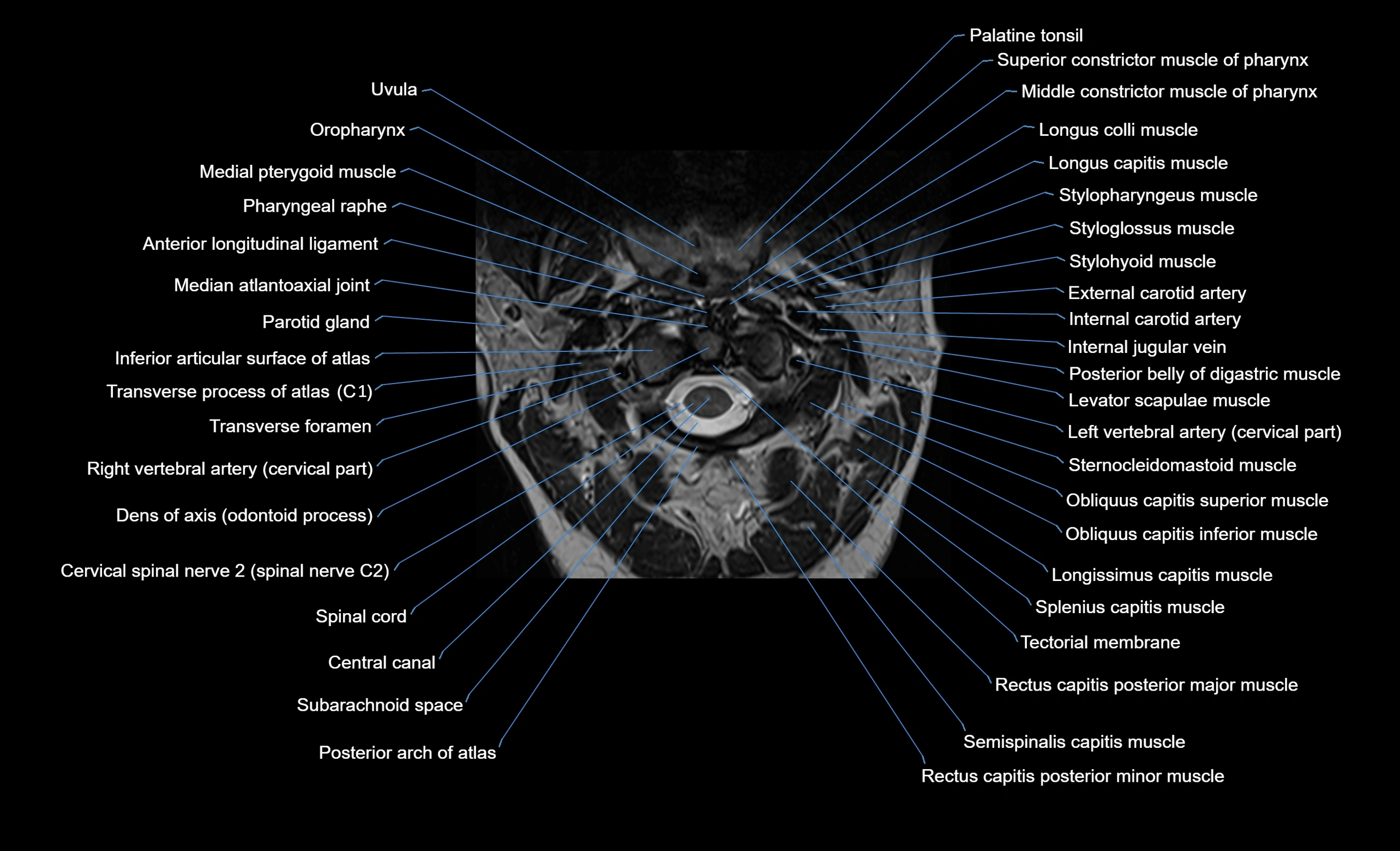 cervical spine cross sectional MRI anatomy  3T MRI axial  image-img-00001-00007.webp